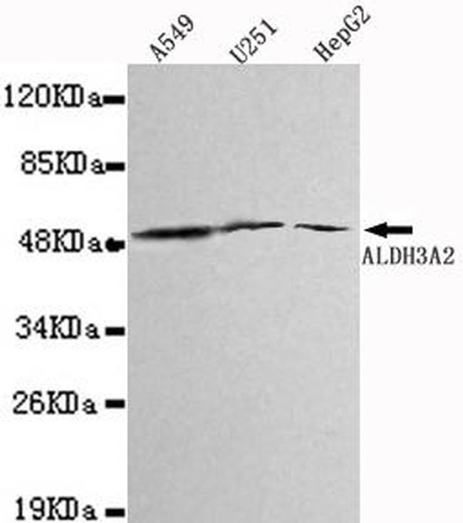 ALDH3A2 Antibody in Western Blot (WB)