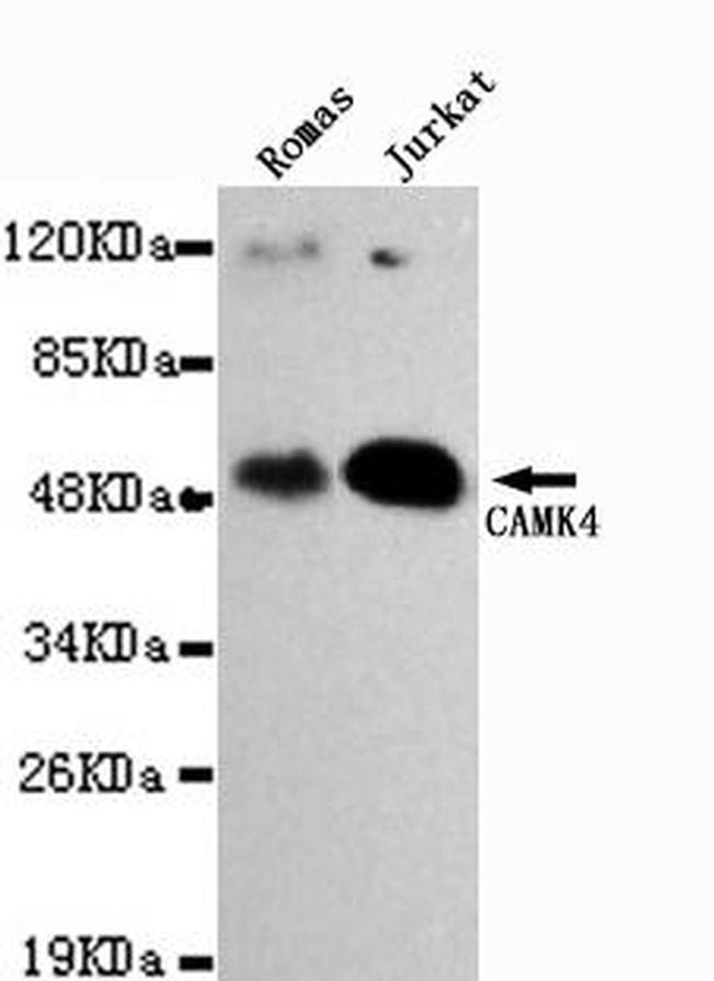 CaMKIV Antibody in Western Blot (WB)