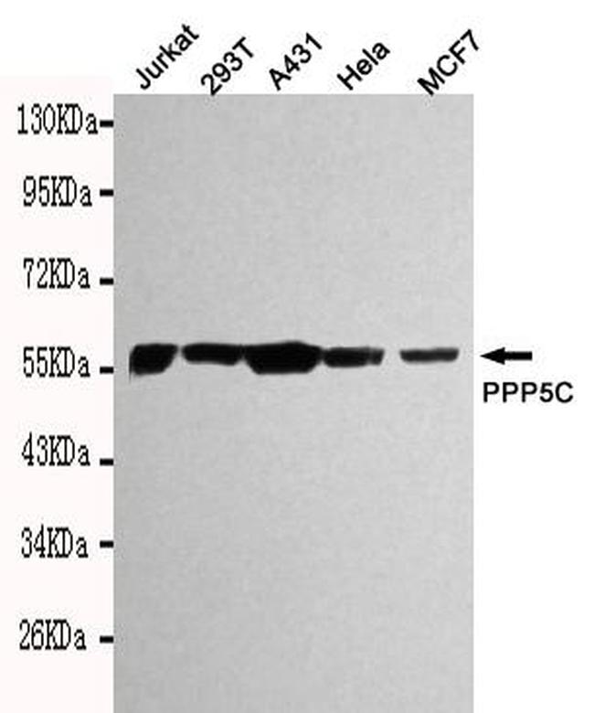 PP5 Antibody in Western Blot (WB)