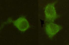 MPI Antibody in Immunocytochemistry (ICC/IF)