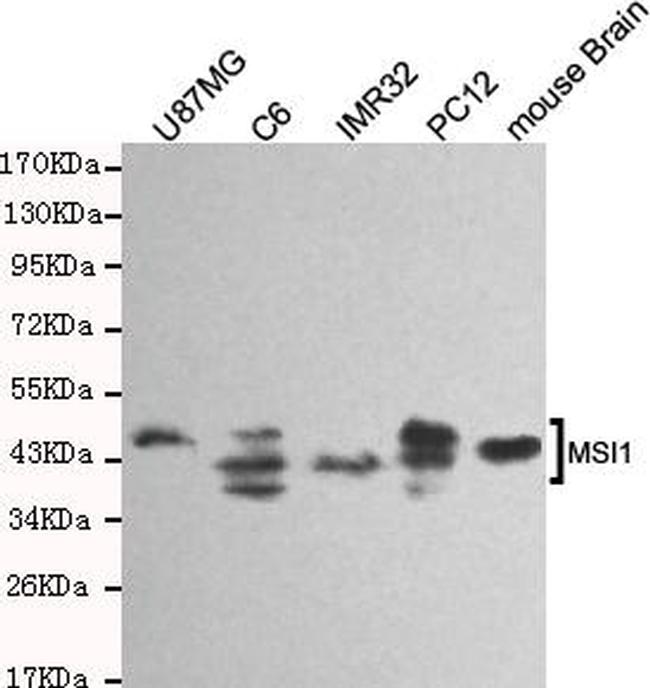 MSI1 Antibody in Western Blot (WB)