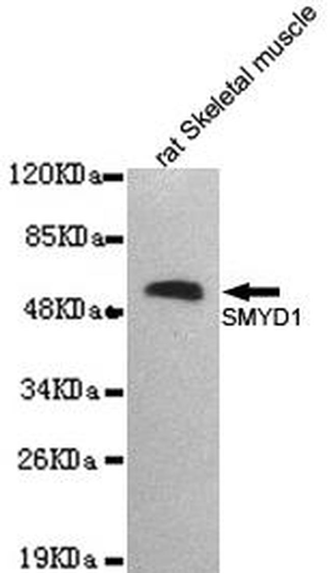 SMYD1 Antibody in Western Blot (WB)