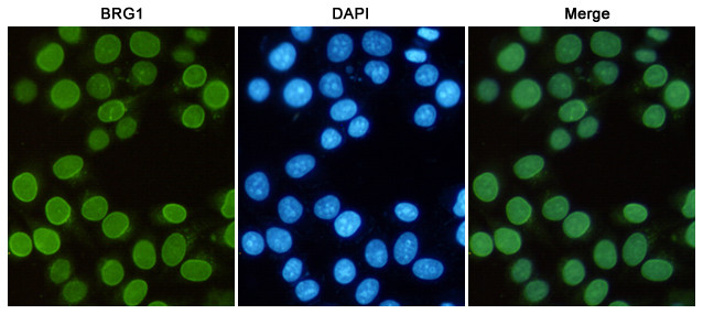 BRG1 Antibody in Immunocytochemistry (ICC/IF)