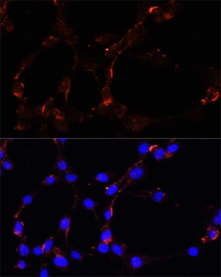 VDAC Antibody in Immunocytochemistry (ICC/IF)