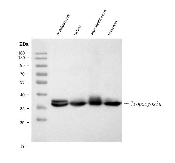 TPM1 Antibody in Western Blot (WB)