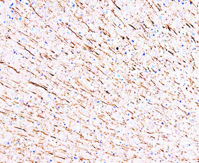 MAP1A Antibody in Immunohistochemistry (Paraffin) (IHC (P))