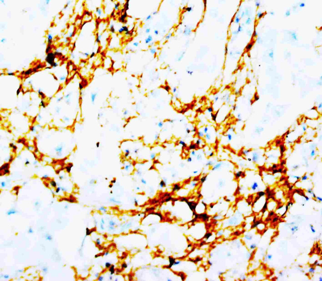 TNN Antibody in Immunohistochemistry (Paraffin) (IHC (P))