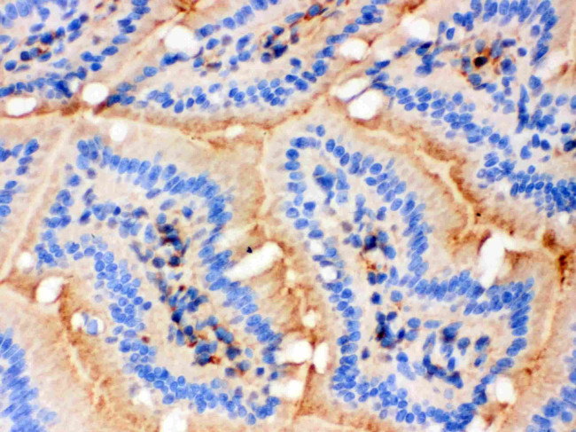ACTA1 Antibody in Immunohistochemistry (Frozen) (IHC (F))