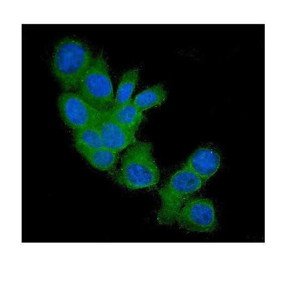 FHIT Antibody in Immunocytochemistry (ICC/IF)