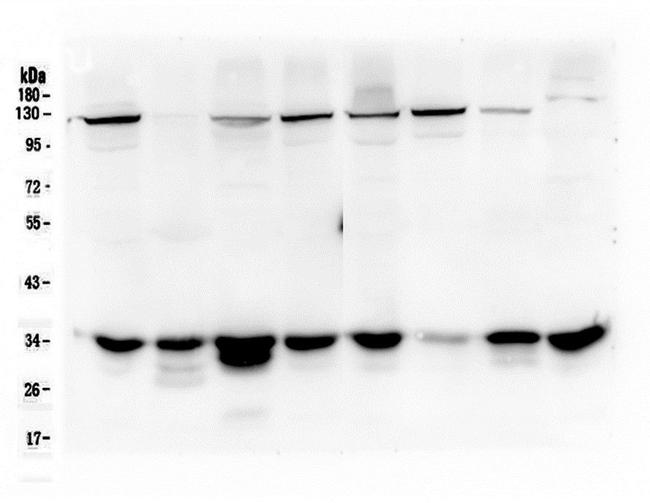 AMPK beta-2 Antibody in Western Blot (WB)