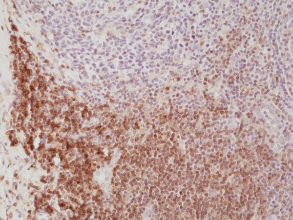 CD4 Antibody in Immunohistochemistry (Paraffin) (IHC (P))