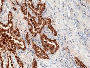 SFTPB Precursor Antibody in Immunohistochemistry (Paraffin) (IHC (P))