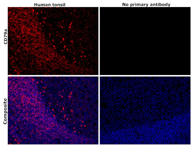 CD79a Antibody in Immunohistochemistry (Paraffin) (IHC (P))