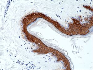 Cytokeratin 10 Antibody in Immunohistochemistry (Paraffin) (IHC (P))