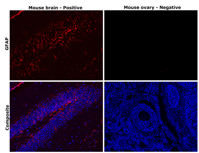 GFAP Antibody in Immunohistochemistry (Paraffin) (IHC (P))