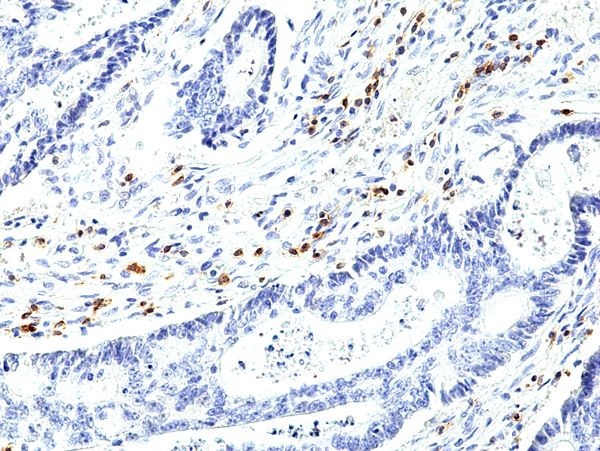 CD5 Antibody in Immunohistochemistry (Paraffin) (IHC (P))