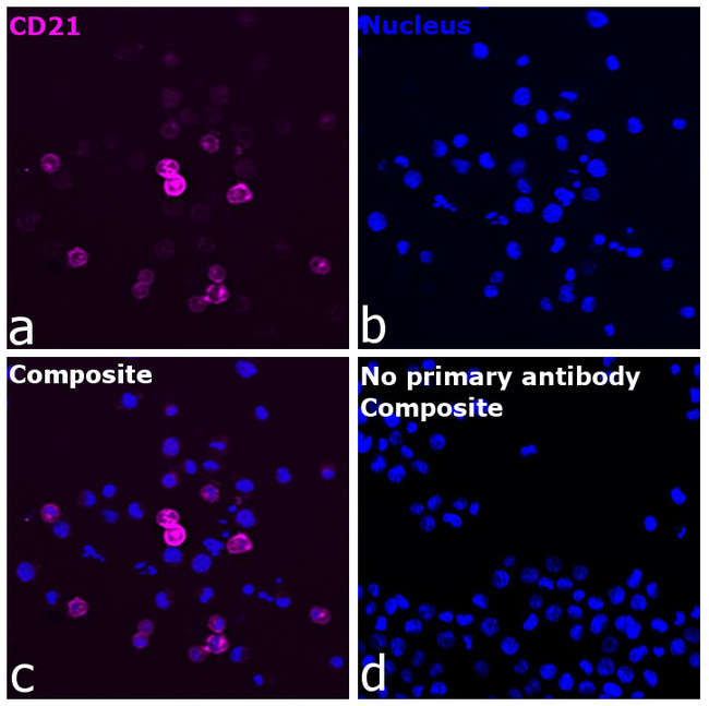 CD21 Antibody in Immunocytochemistry (ICC/IF)