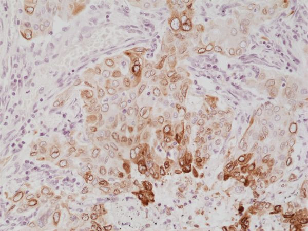 COX2 Antibody in Immunohistochemistry (Paraffin) (IHC (P))