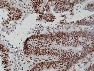 MSH6 Antibody in Immunohistochemistry (Paraffin) (IHC (P))