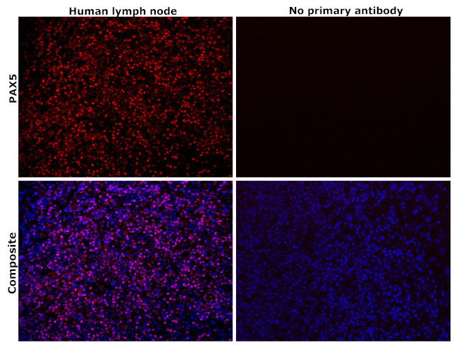 PAX5 Antibody in Immunohistochemistry (Paraffin) (IHC (P))