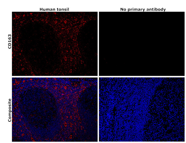 CD163 Antibody in Immunohistochemistry (Paraffin) (IHC (P))
