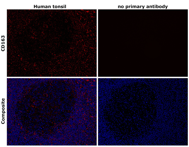 CD163 Antibody in Immunohistochemistry (Paraffin) (IHC (P))