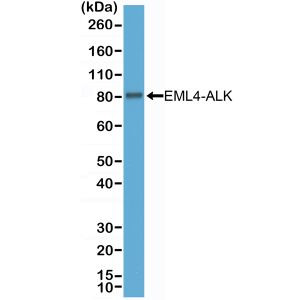 ALK Antibody in Western Blot (WB)