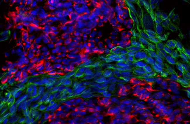 Peripherin Antibody in Immunocytochemistry (ICC/IF)