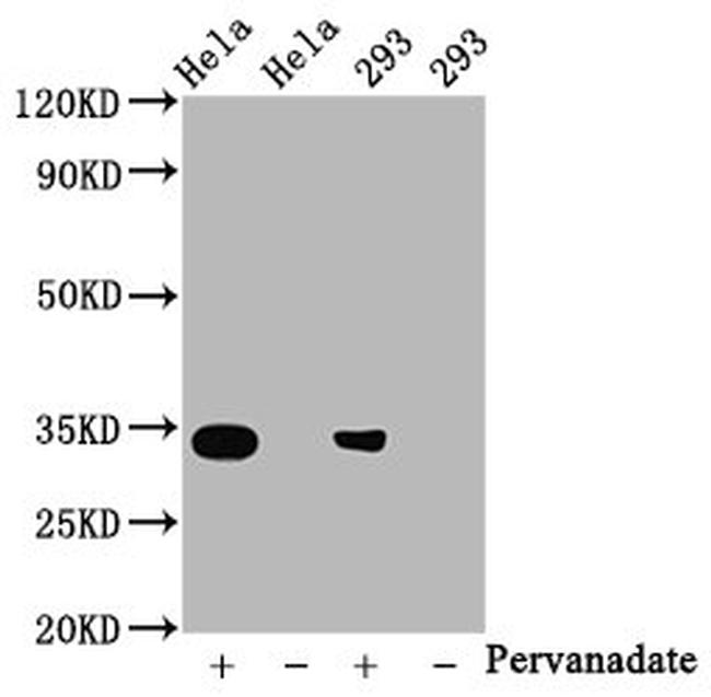Phospho-CDK2 (Tyr15) Antibody in Western Blot (WB)