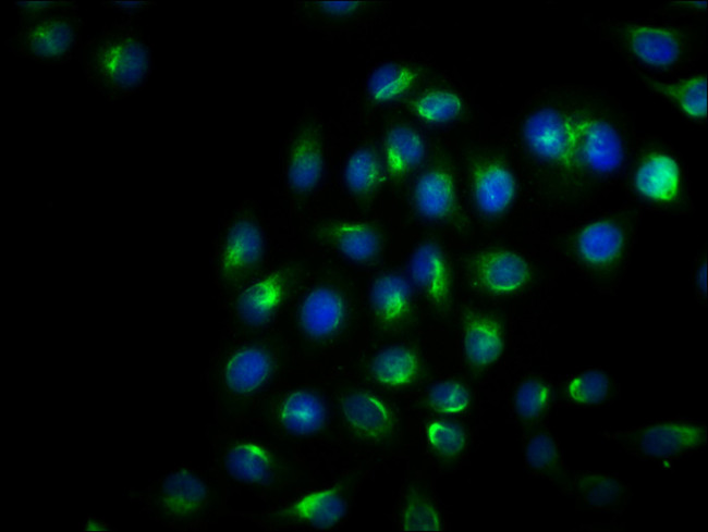 Phospho-IRE1 alpha (Ser724) Antibody in Immunocytochemistry (ICC/IF)