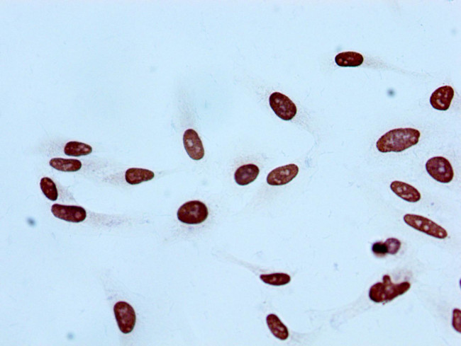 H2BK20ac (type 1-B) Antibody in Immunocytochemistry (ICC/IF)