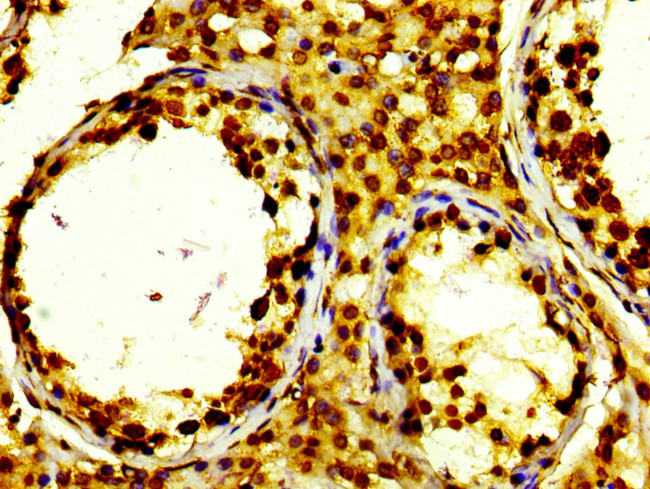 HIST1H2BK Antibody in Immunohistochemistry (Paraffin) (IHC (P))