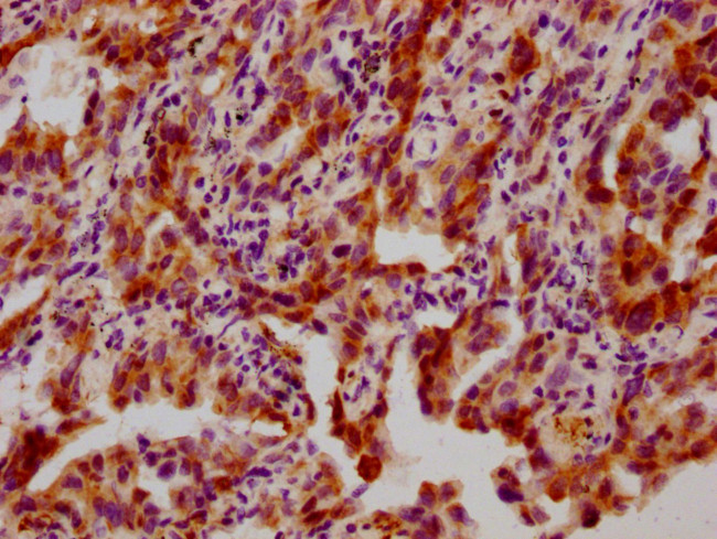 Phospho-HSP27 (Ser82) Antibody in Immunohistochemistry (Paraffin) (IHC (P))