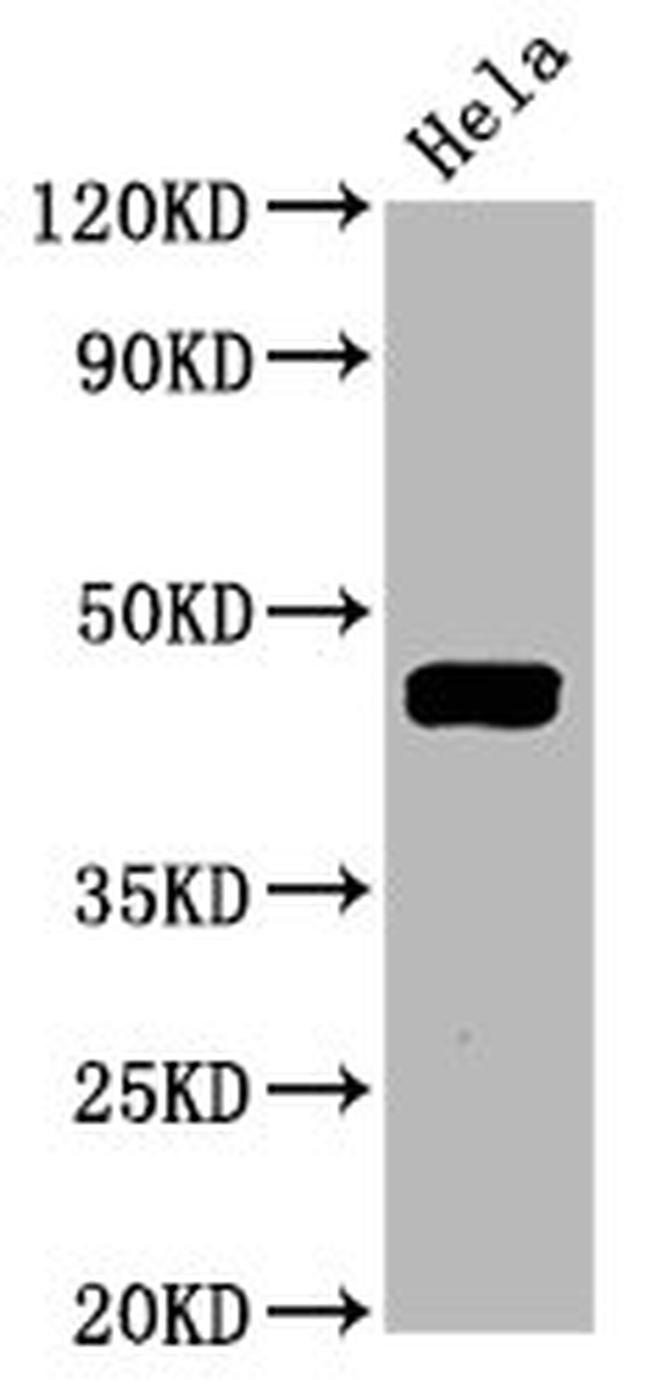 Phospho-MEK1 (Thr292) Antibody in Western Blot (WB)