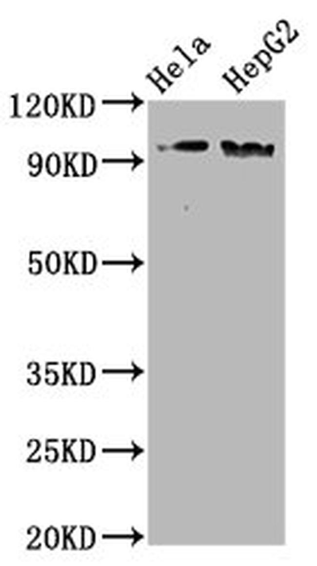 Phospho-NBS1 (Ser343) Antibody in Western Blot (WB)