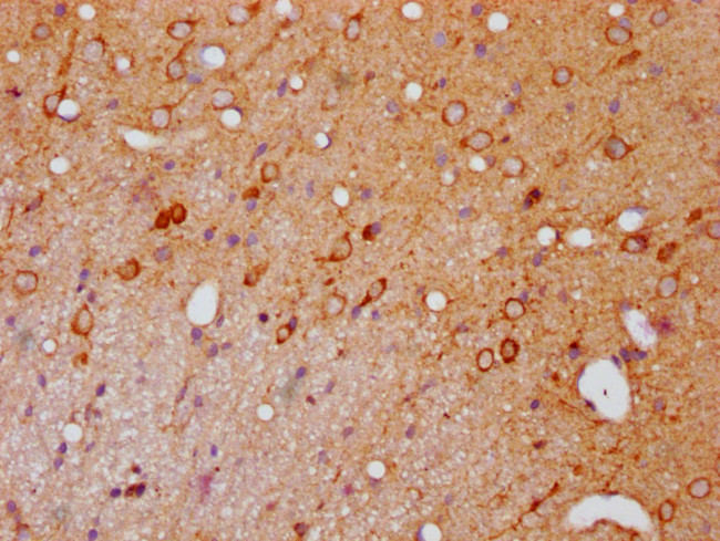 Phospho-PAK1/2/3 (Ser139, Ser141, Ser144) Antibody in Immunohistochemistry (Paraffin) (IHC (P))