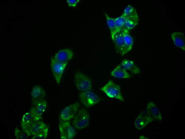 PRKAR1A Antibody in Immunocytochemistry (ICC/IF)