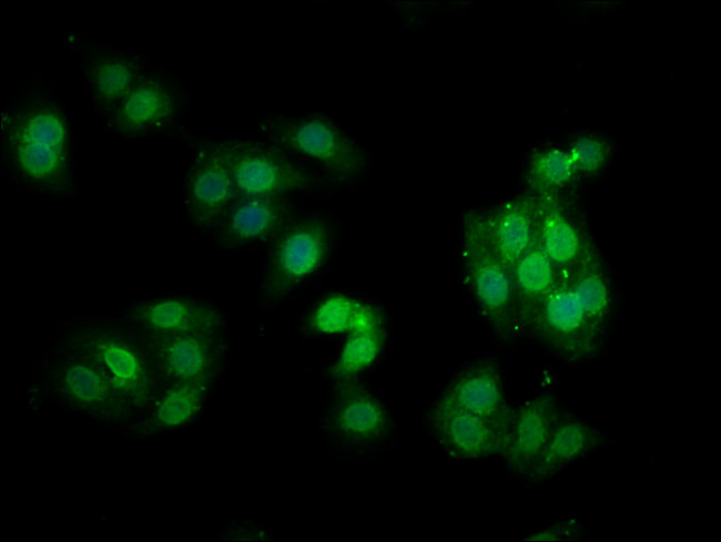 Phospho-PKC alpha (Thr638) Antibody in Immunocytochemistry (ICC/IF)