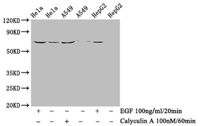 Phospho-Paxillin (Tyr118) Antibody in Western Blot (WB)