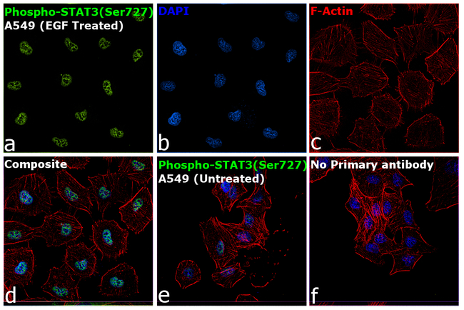 Phospho-STAT3 (Ser727) Antibody in Immunocytochemistry (ICC/IF)
