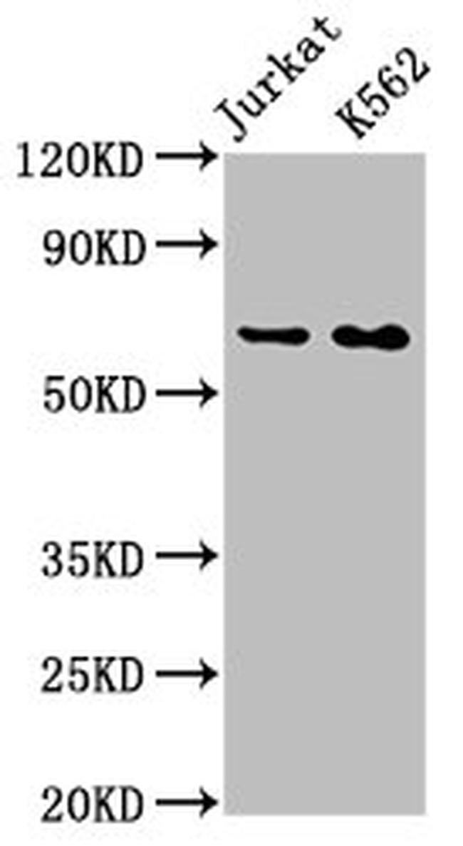 STIP1 Antibody in Western Blot (WB)