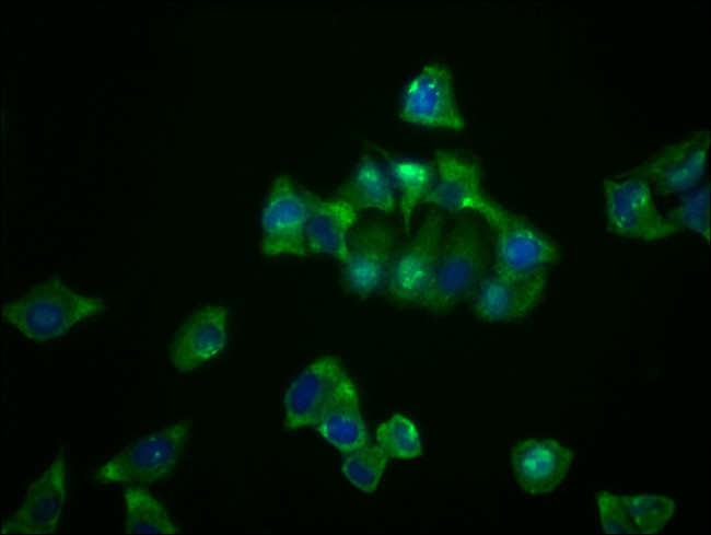 NDRG1 Antibody in Immunocytochemistry (ICC/IF)