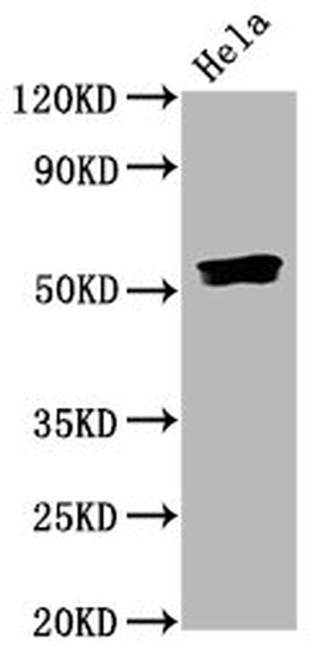 Phospho-SMAD5 (Ser463, Ser465) Antibody in Western Blot (WB)