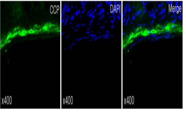 CRYGD Antibody in Immunohistochemistry (IHC)