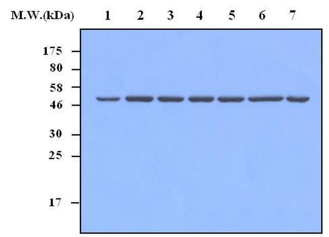 CD49e (Integrin alpha 5) Antibody in Western Blot (WB)