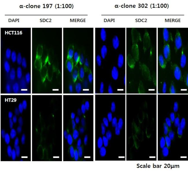 Syndecan 2 Antibody in Immunocytochemistry (ICC/IF)