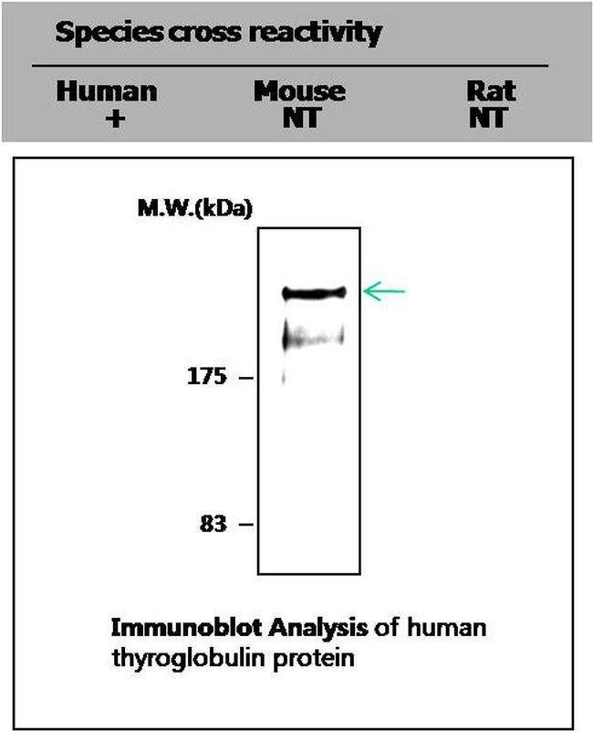 Thyroglobulin Antibody in Western Blot (WB)