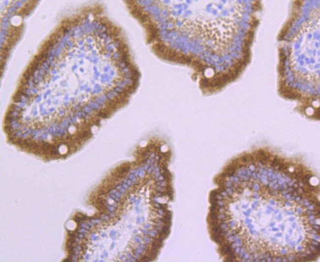 PERP Antibody in Immunohistochemistry (Paraffin) (IHC (P))