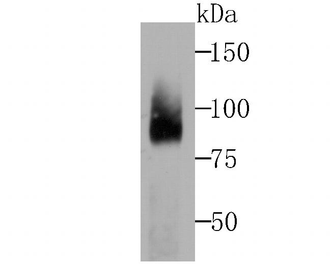 Coilin Antibody in Western Blot (WB)