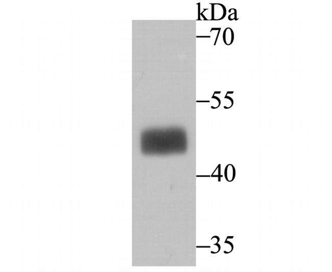MAPKAPK2 Antibody in Western Blot (WB)